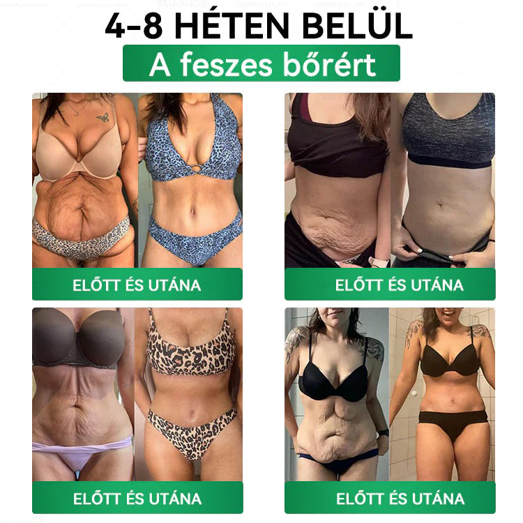 A🇭🇺Európai egészségügyi előírásoknak megfelelő · 👩‍⚕️Orvosi szakértők által ajánlott termék| 🎁 𝑷𝒖𝒓𝐞𝐿𝒖𝒙𝐨® Glumasetide 8 az 1-ben Karcsú és Egészséges Nano Mikrotűs Tapasz🔥🔥🔥