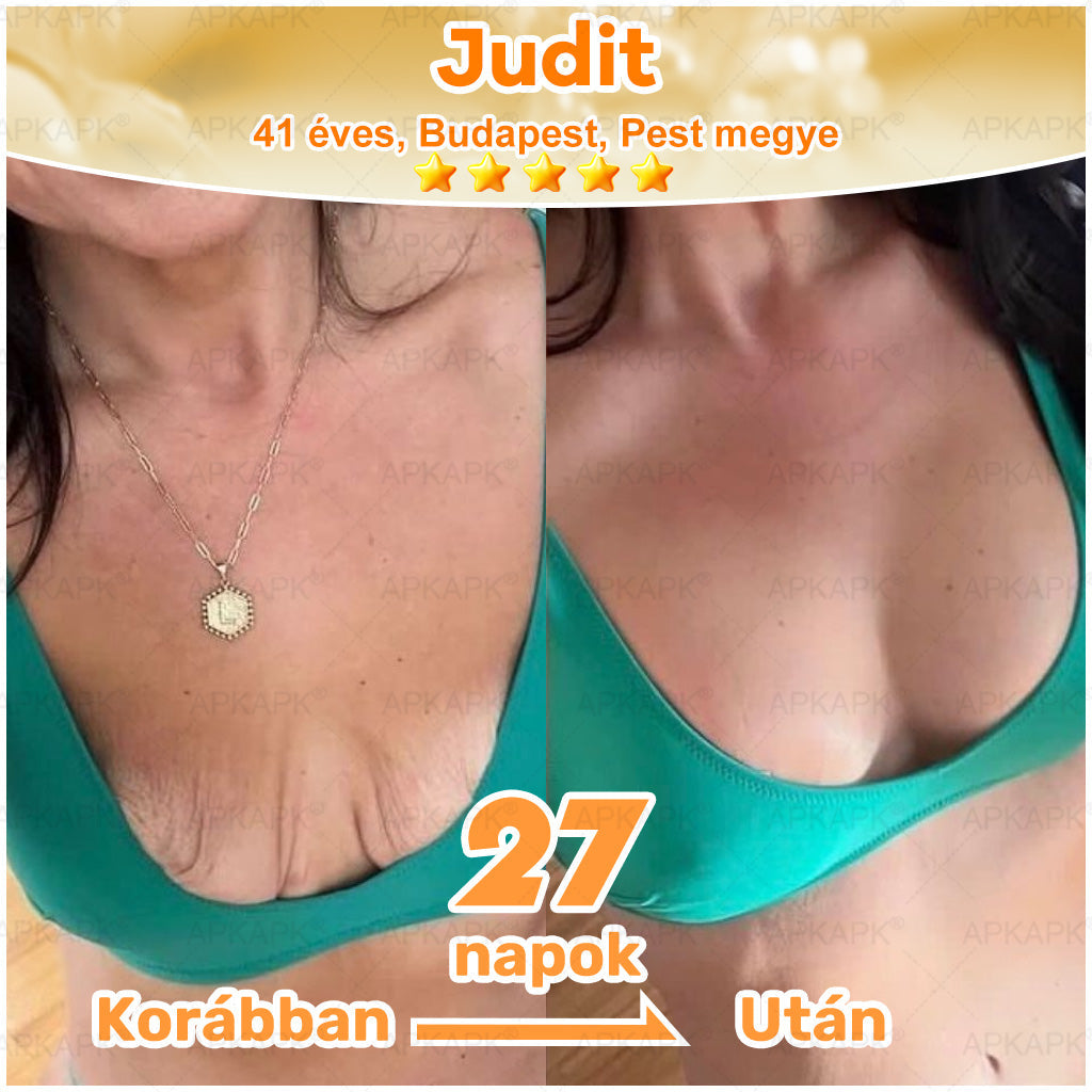 🎁🧡APKAPK®  Méhméreg krém a bőr megújítására 🐝 segít megoldani olyan bőrproblémákat, mint: ráncok, hegek, pigmentfoltok, striák, akné, pikkelysömör, ekcéma, bőrelváltozások, irritációk, gyulladások és egyéb bőrpanaszok.🧡🐝🐝