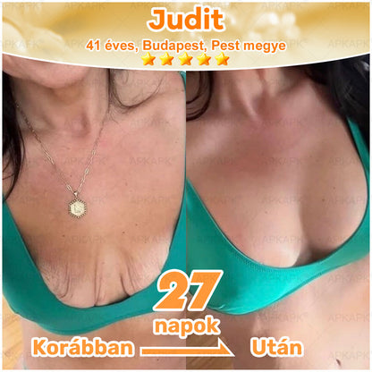 🎁🧡APKAPK®  Méhméreg krém a bőr megújítására 🐝 segít megoldani olyan bőrproblémákat, mint: ráncok, hegek, pigmentfoltok, striák, akné, pikkelysömör, ekcéma, bőrelváltozások, irritációk, gyulladások és egyéb bőrpanaszok.🧡🐝🐝