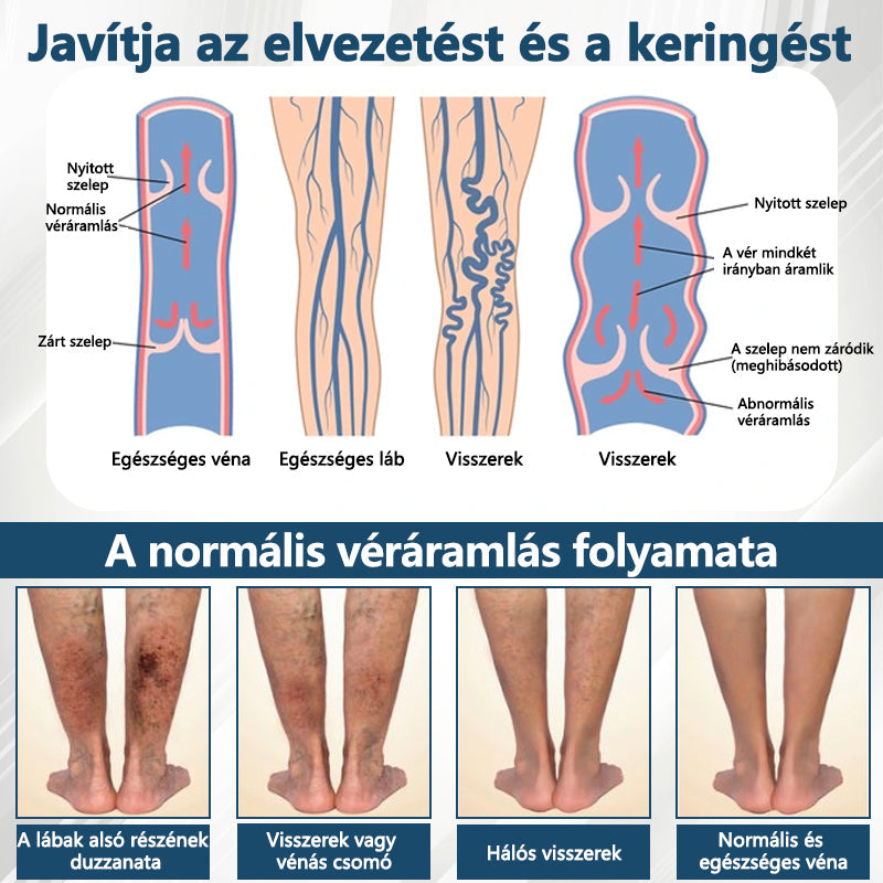 💧ATTDX® Növényi ödéma enyhítő krém nigellával💧💧💧