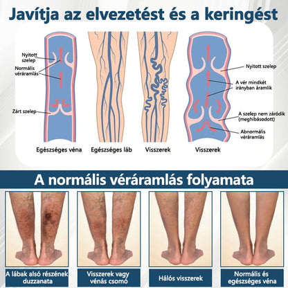 💧ATTDX® Növényi ödéma enyhítő krém nigellával💧💧💧