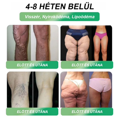 A🇭🇺Európai egészségügyi előírásoknak megfelelő · 👩‍⚕️Orvosi szakértők által ajánlott termék| 🎁 𝑷𝒖𝒓𝐞𝐿𝒖𝒙𝐨® Glumasetide 8 az 1-ben Karcsú és Egészséges Nano Mikrotűs Tapasz🔥🔥🔥