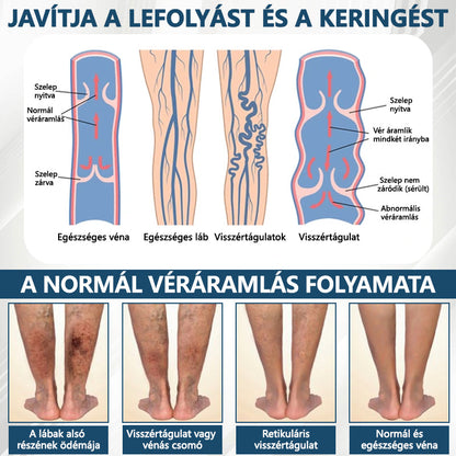 Cvreoz® Fekete kömény Ödéma méregtelenítő gyógynövénykrém - a gyors, látható enyhülés érdekében🍃