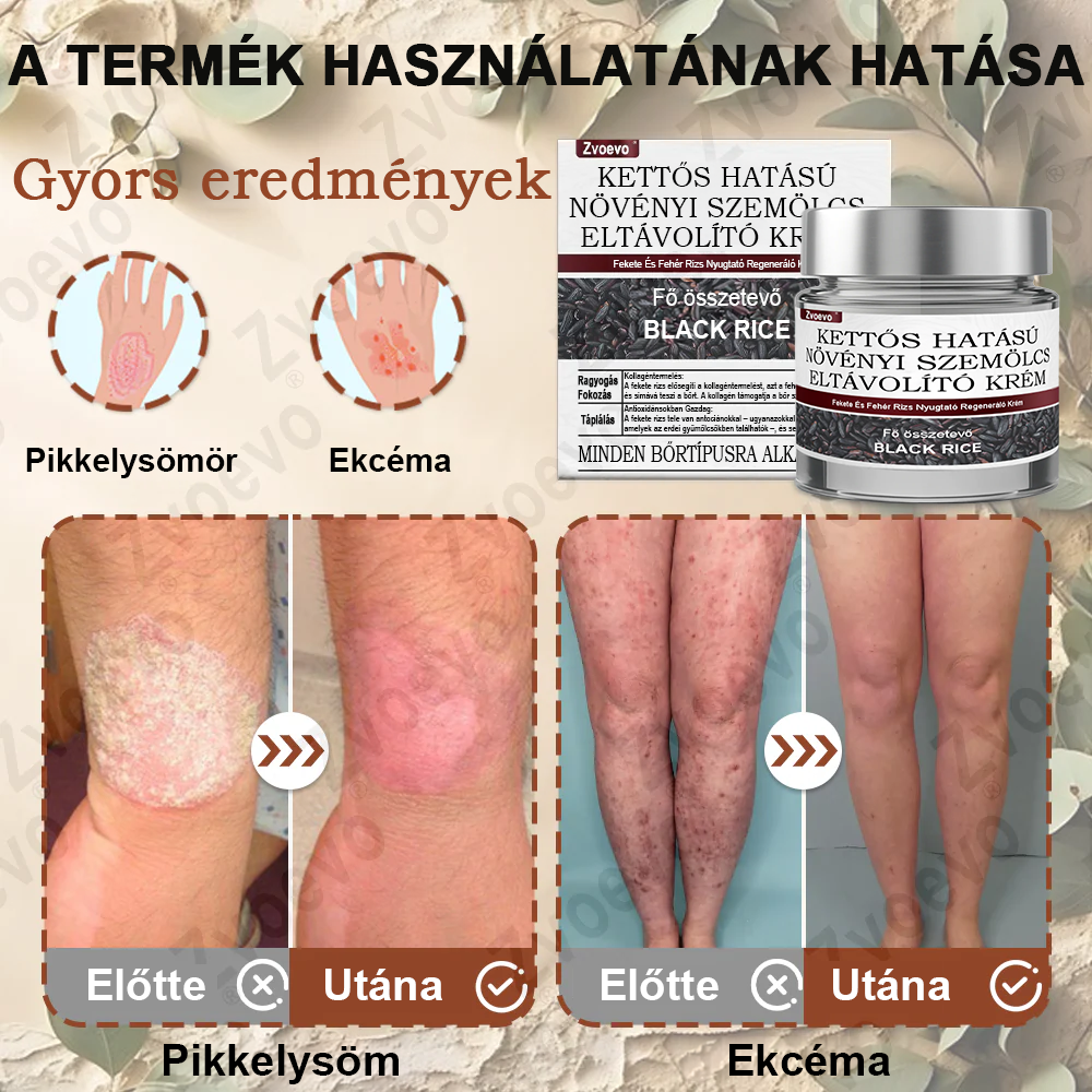 ✅ Pureluxo® Fekete Rizses Bőrregeneráló Krém 👨‍⚕️ (Szemölcsök, bőrkinövések, foltok és hiperpigmentáció kezelésére)✅✅✅