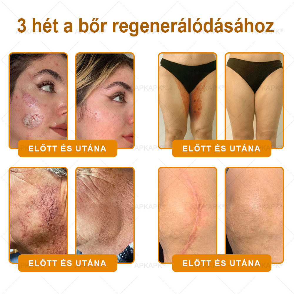 🎁🧡APKAPK®  Méhméreg krém a bőr megújítására 🐝 segít megoldani olyan bőrproblémákat, mint: ráncok, hegek, pigmentfoltok, striák, akné, pikkelysömör, ekcéma, bőrelváltozások, irritációk, gyulladások és egyéb bőrpanaszok.🧡🐝🐝