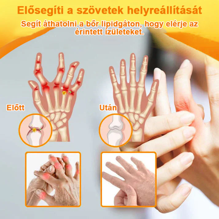 ✅ Hivatalos áruház: Ouryard™ Magnéziumolaj és Mézes Ízületjavító Spray 👨‍⚕️ Jóváhagyva a Magyar Gyógyszerészeti és Egészségügyi Minőség- és Szervezetfejlesztési Intézet (OGYÉI) által. 🔥