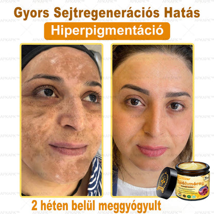 𝐀𝐏𝐊𝐀𝐏𝐊™ 𝐌É𝐇𝐌É𝐑𝐄𝐆 Á𝐓𝐅𝐎𝐆Ó 𝐊𝐑É𝐌🥇🥇𝐀 𝐛ö𝐫𝐩𝐫𝐨𝐛𝐥é𝐦á𝐤 𝐤𝐞𝐳𝐞𝐥é𝐬𝐞 𝐦𝐚𝐠á𝐛𝐚𝐧 𝐟𝐨𝐠𝐥𝐚𝐥𝐣𝐚: é𝐥𝐞𝐭𝐤𝐨𝐫𝐢 𝐟𝐨𝐥𝐭𝐨𝐤, 𝐡𝐞𝐠𝐞𝐤, 𝐬𝐳𝐞𝐦ö𝐥𝐜𝐬ö𝐤, 𝐛ö𝐫𝐧ö𝐯𝐞𝐝é𝐤𝐞𝐤, 𝐭á𝐥𝐲𝐨𝐠𝐨𝐤, 𝐩𝐚𝐭𝐭𝐚𝐧á𝐬𝐨𝐤, 𝐞𝐤𝐜é𝐦𝐚, 𝐩𝐬𝐨𝐫𝐢𝐚𝐬𝐢𝐬, 𝐚𝐜𝐧𝐞 𝐢𝐧𝐯𝐞𝐫𝐬𝐚, 𝐫á𝐧𝐜𝐨𝐤, 𝐛ö𝐫ö𝐫𝐞𝐠𝐞𝐝é𝐬 é𝐬 𝐞𝐠𝐲é𝐛 𝐩𝐫𝐨𝐛𝐥é𝐦á𝐤🔥🔥🔥🔥