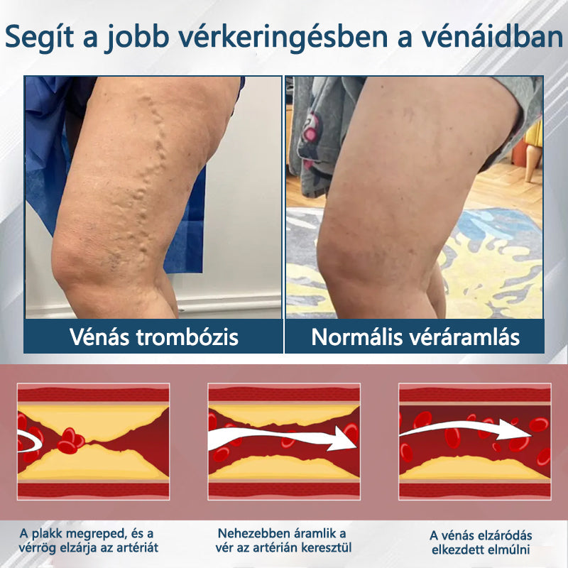 💧ATTDX® Növényi ödéma enyhítő krém nigellával💧💧💧