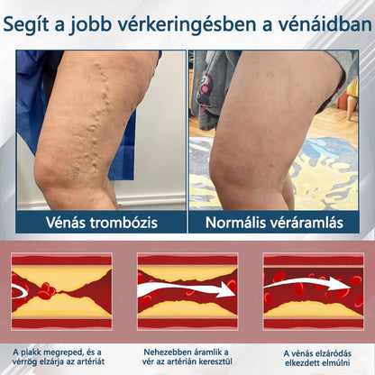 💧ATTDX® Növényi ödéma enyhítő krém nigellával💧💧💧