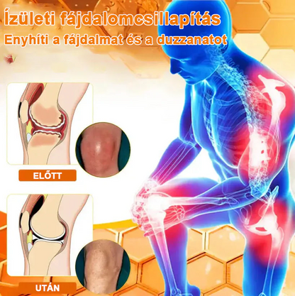 ✅ Hivatalos áruház: Ouryard™ Magnéziumolaj és Mézes Ízületjavító Spray 👨‍⚕️ Jóváhagyva a Magyar Gyógyszerészeti és Egészségügyi Minőség- és Szervezetfejlesztési Intézet (OGYÉI) által. 🔥