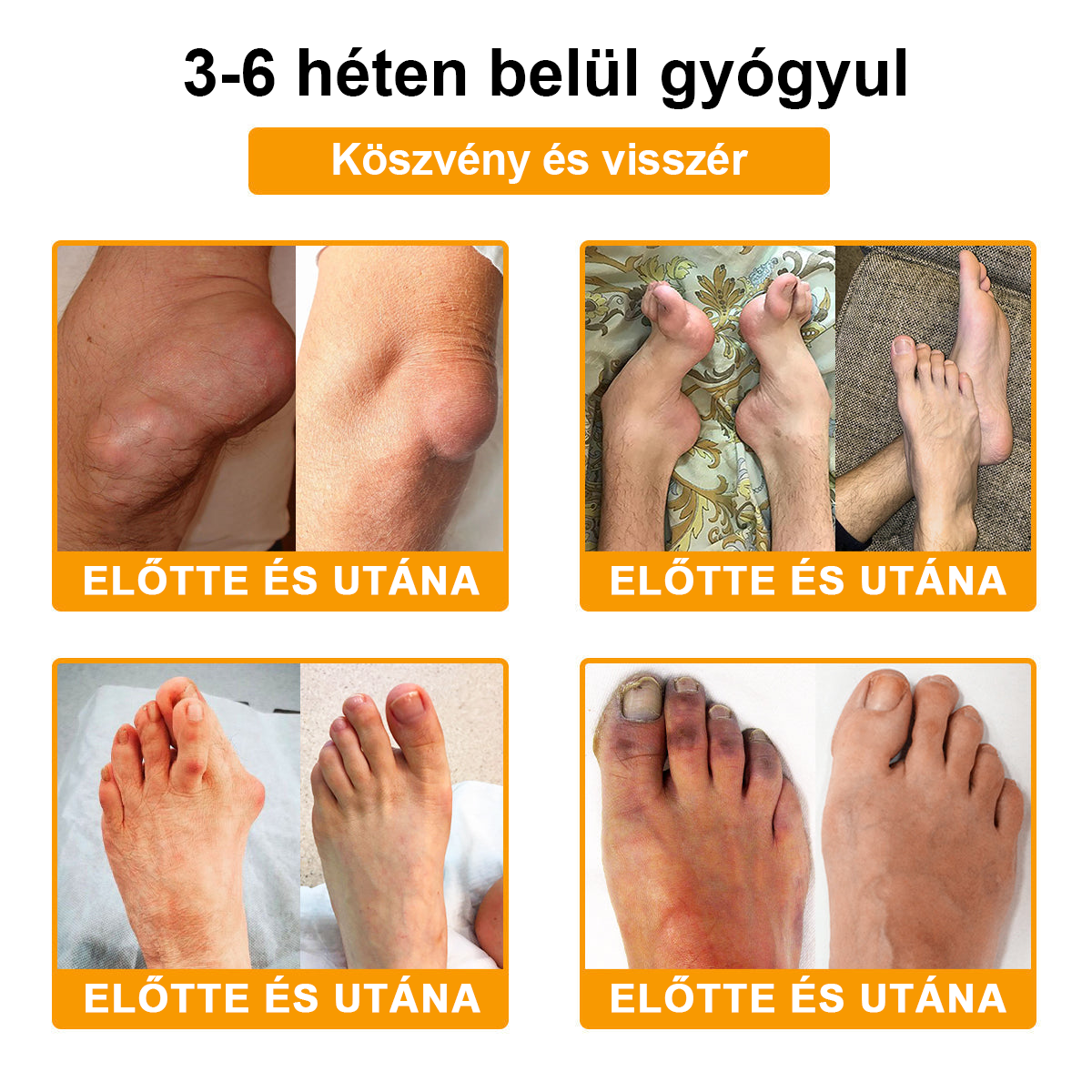 🦴TLOPA® Botulinum Toxin és Méhméreg Fájdalomcsillapító Csontgyógyító Krém🐝 🔥(Kifejezetten időseknek & ortopéd szakorvosok ajánlásával)🦴🦴