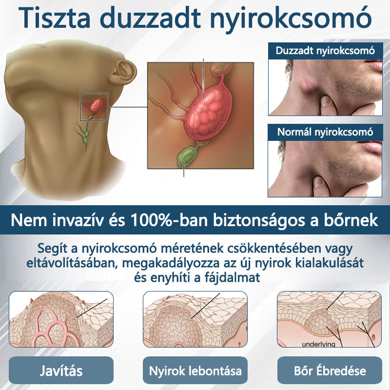 Cvreoz® Fekete kömény Ödéma méregtelenítő gyógynövénykrém - a gyors, látható enyhülés érdekében🍃