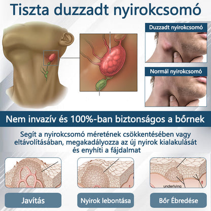 Cvreoz® Fekete kömény Ödéma méregtelenítő gyógynövénykrém - a gyors, látható enyhülés érdekében🍃