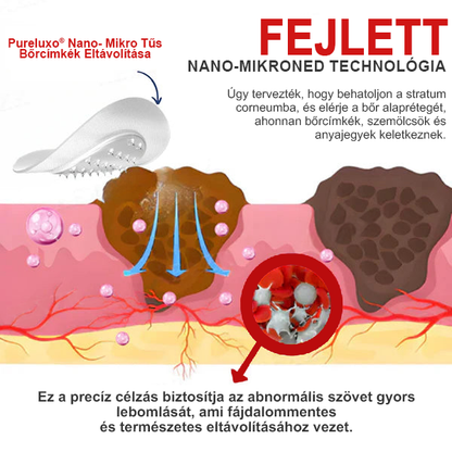 Pureluxo® Nano-mikrotűs bőrcímke-eltávolító tapaszok✨✨✨✨