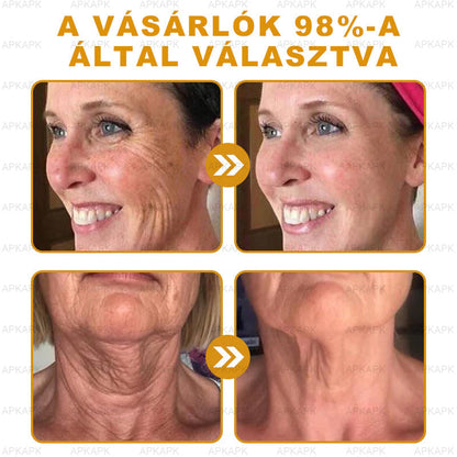 𝐀𝐏𝐊𝐀𝐏𝐊™ 𝐌É𝐇𝐌É𝐑𝐄𝐆 Á𝐓𝐅𝐎𝐆Ó 𝐊𝐑É𝐌🥇🥇𝐀 𝐛ö𝐫𝐩𝐫𝐨𝐛𝐥é𝐦á𝐤 𝐤𝐞𝐳𝐞𝐥é𝐬𝐞 𝐦𝐚𝐠á𝐛𝐚𝐧 𝐟𝐨𝐠𝐥𝐚𝐥𝐣𝐚: é𝐥𝐞𝐭𝐤𝐨𝐫𝐢 𝐟𝐨𝐥𝐭𝐨𝐤, 𝐡𝐞𝐠𝐞𝐤, 𝐬𝐳𝐞𝐦ö𝐥𝐜𝐬ö𝐤, 𝐛ö𝐫𝐧ö𝐯𝐞𝐝é𝐤𝐞𝐤, 𝐭á𝐥𝐲𝐨𝐠𝐨𝐤, 𝐩𝐚𝐭𝐭𝐚𝐧á𝐬𝐨𝐤, 𝐞𝐤𝐜é𝐦𝐚, 𝐩𝐬𝐨𝐫𝐢𝐚𝐬𝐢𝐬, 𝐚𝐜𝐧𝐞 𝐢𝐧𝐯𝐞𝐫𝐬𝐚, 𝐫á𝐧𝐜𝐨𝐤, 𝐛ö𝐫ö𝐫𝐞𝐠𝐞𝐝é𝐬 é𝐬 𝐞𝐠𝐲é𝐛 𝐩𝐫𝐨𝐛𝐥é𝐦á𝐤🔥🔥🔥🔥