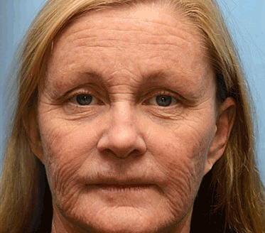 𝐀𝐏𝐊𝐀𝐏𝐊™ 𝐌É𝐇𝐌É𝐑𝐄𝐆 Á𝐓𝐅𝐎𝐆Ó 𝐊𝐑É𝐌🥇🥇𝐀 𝐛ö𝐫𝐩𝐫𝐨𝐛𝐥é𝐦á𝐤 𝐤𝐞𝐳𝐞𝐥é𝐬𝐞 𝐦𝐚𝐠á𝐛𝐚𝐧 𝐟𝐨𝐠𝐥𝐚𝐥𝐣𝐚: é𝐥𝐞𝐭𝐤𝐨𝐫𝐢 𝐟𝐨𝐥𝐭𝐨𝐤, 𝐡𝐞𝐠𝐞𝐤, 𝐬𝐳𝐞𝐦ö𝐥𝐜𝐬ö𝐤, 𝐛ö𝐫𝐧ö𝐯𝐞𝐝é𝐤𝐞𝐤, 𝐭á𝐥𝐲𝐨𝐠𝐨𝐤, 𝐩𝐚𝐭𝐭𝐚𝐧á𝐬𝐨𝐤, 𝐞𝐤𝐜é𝐦𝐚, 𝐩𝐬𝐨𝐫𝐢𝐚𝐬𝐢𝐬, 𝐚𝐜𝐧𝐞 𝐢𝐧𝐯𝐞𝐫𝐬𝐚, 𝐫á𝐧𝐜𝐨𝐤, 𝐛ö𝐫ö𝐫𝐞𝐠𝐞𝐝é𝐬 é𝐬 𝐞𝐠𝐲é𝐛 𝐩𝐫𝐨𝐛𝐥é𝐦á𝐤🔥🔥🔥🔥